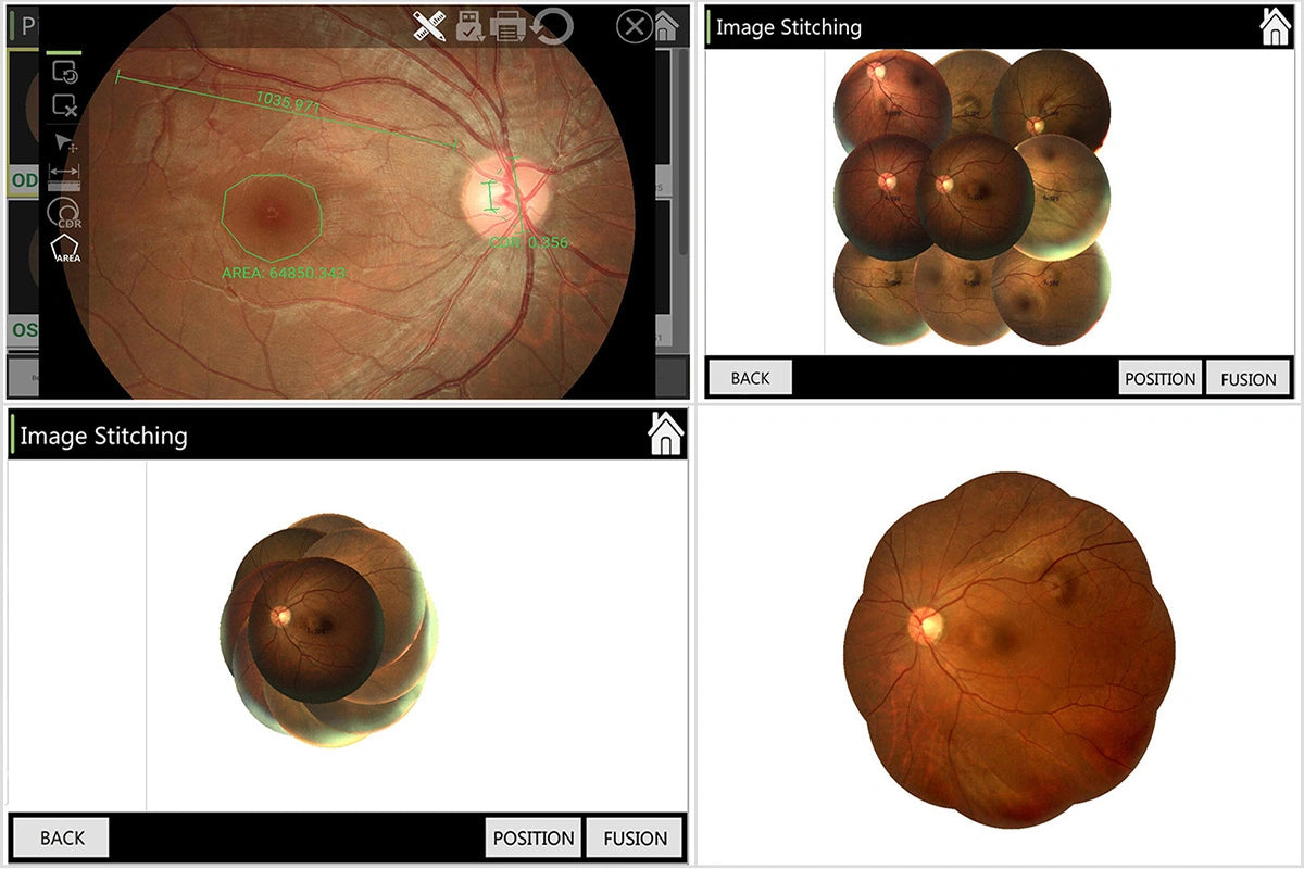 Cámara Retinal No Midriática RetiCam-5100 PRO (*Angio/AutoFluor)