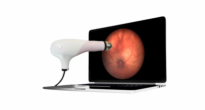 Sistema Retinal de Campo Amplio SK-8000