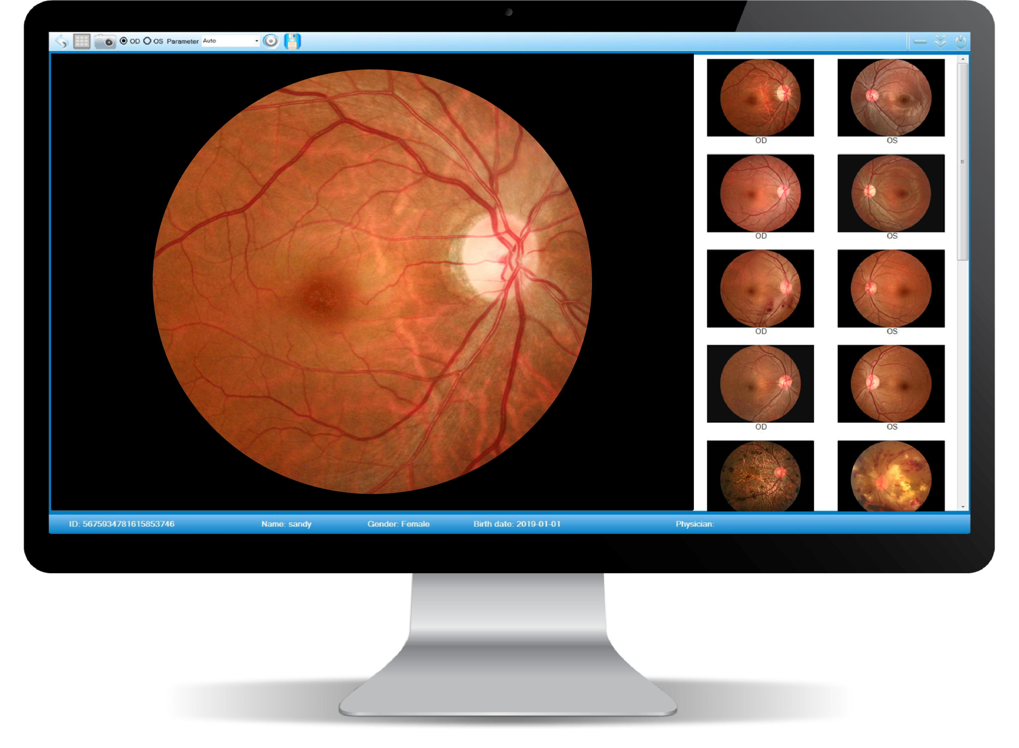 Cámara Retinal No Midriática + Angiográfo SK-650B