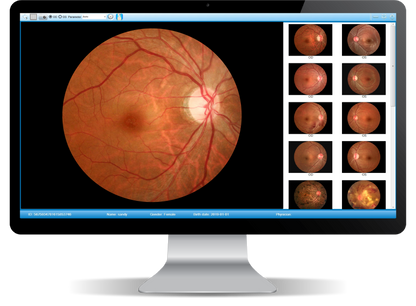 Cámara Retinal No Midriática + Angiográfo SK-650B