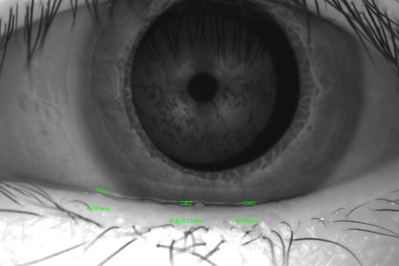 Analizador de Superficie Ocular Avanzado DA-3