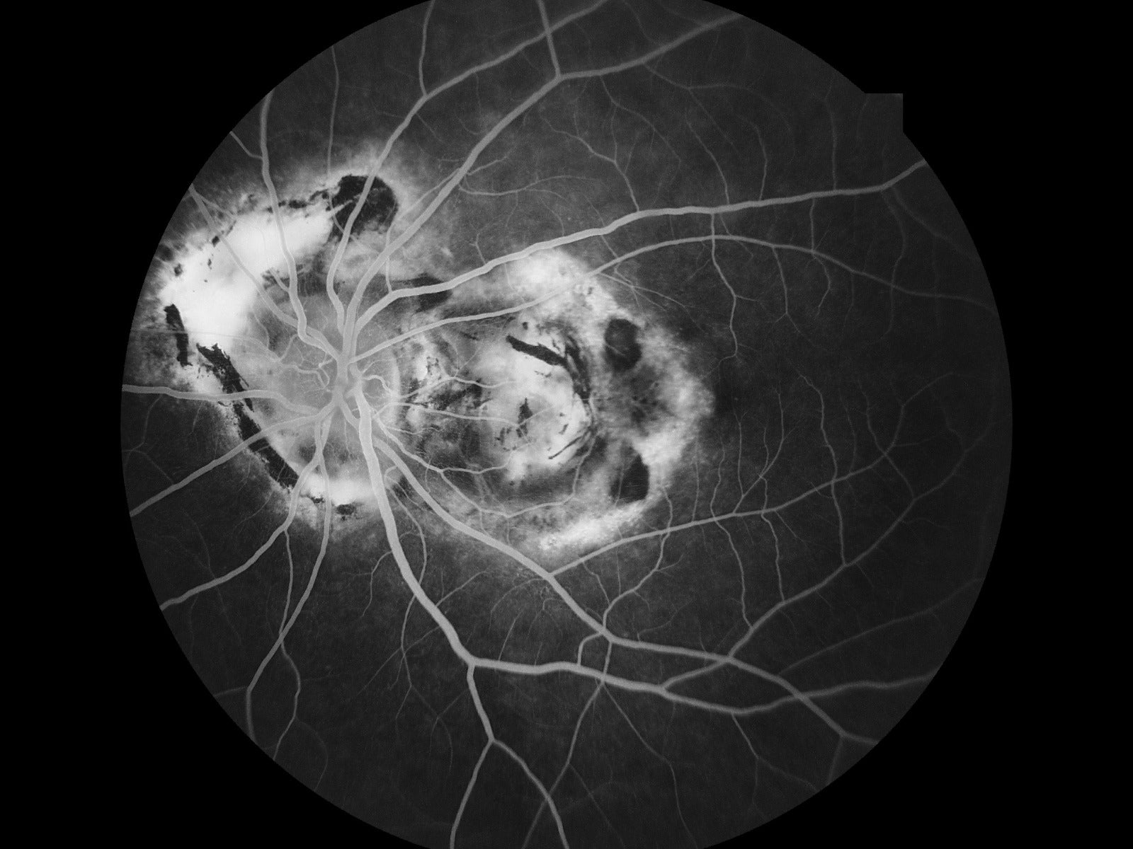 Cámara Retinal No Midriática RetiCam-5100 PRO (*Angio/AutoFluor)