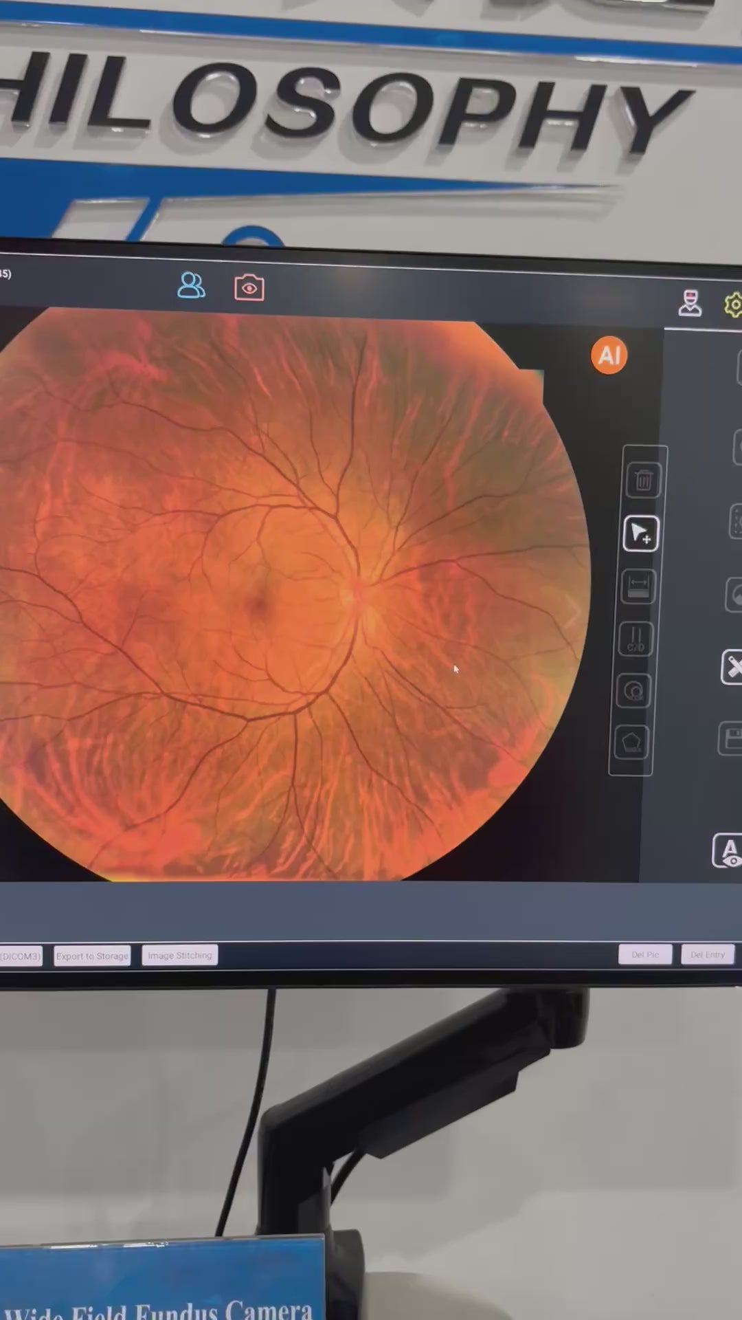 Cámara Retinal Ultra Wide Field RetiCam PLUS