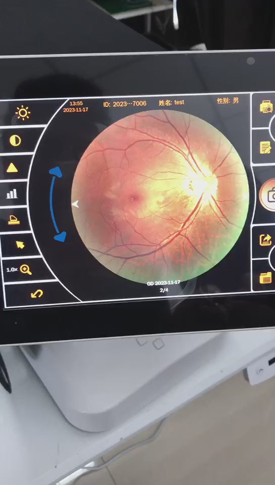 Cámara Retinal No Midriatica SK-680 A