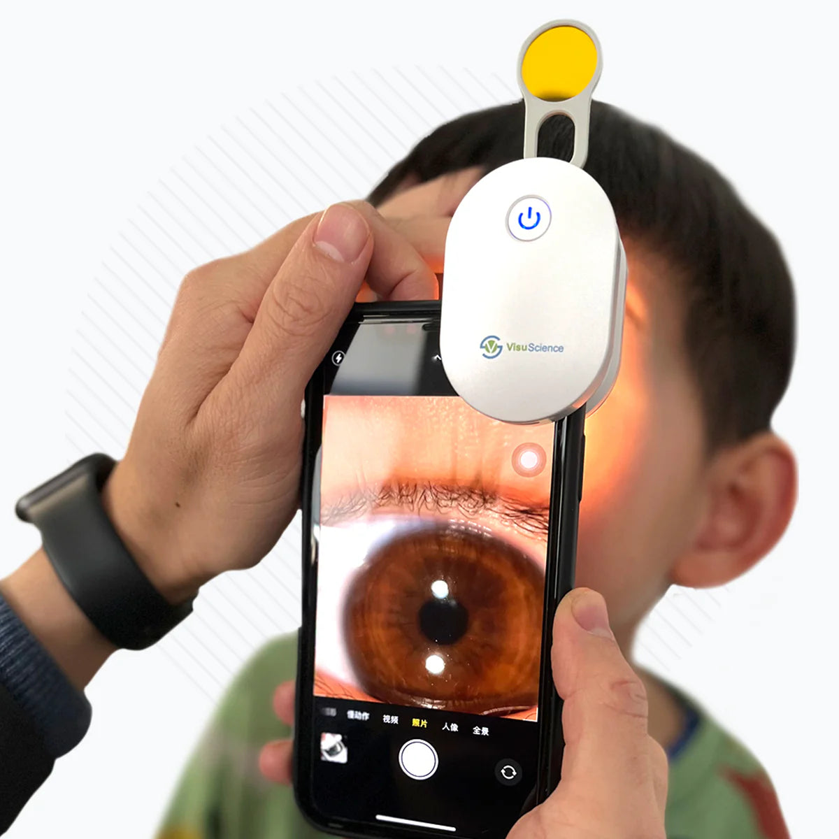 Adaptador de Imagen Ocular QuickVue Plus
