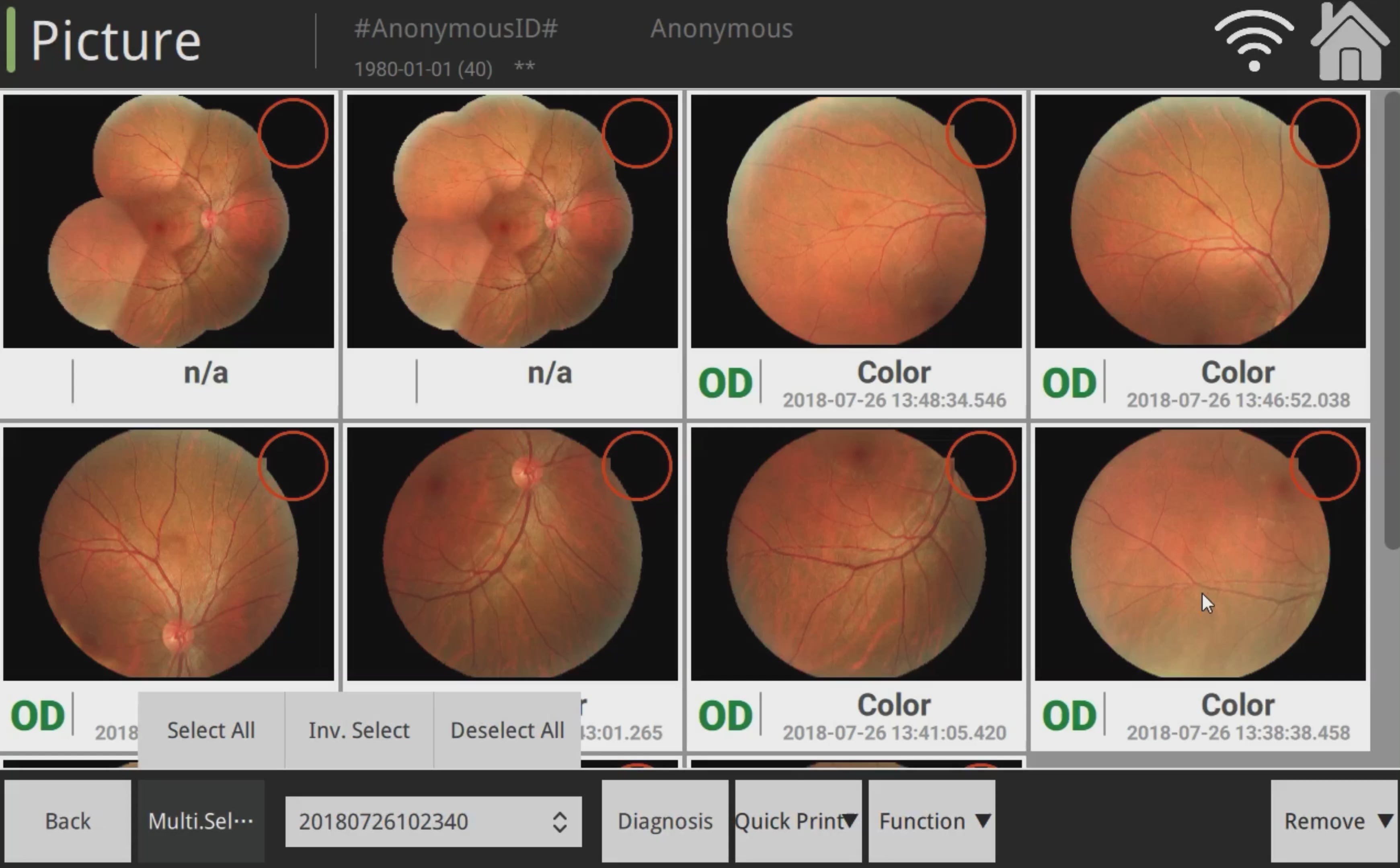 Cámara Retinal No Midriática RetiCam-5100 PRO (*Angio/AutoFluor)