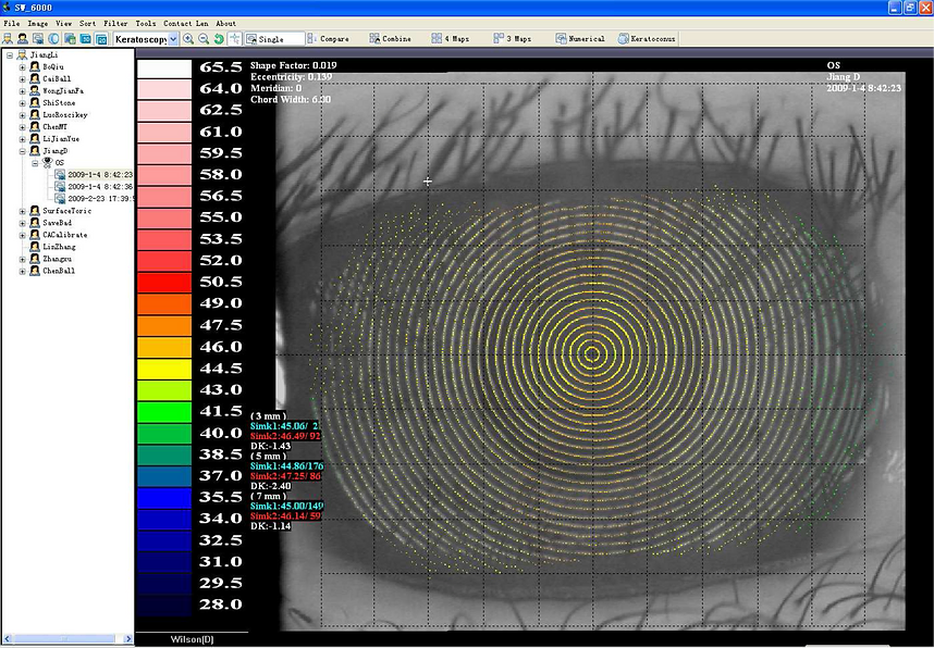 Topógrafo Corneal SW-6000