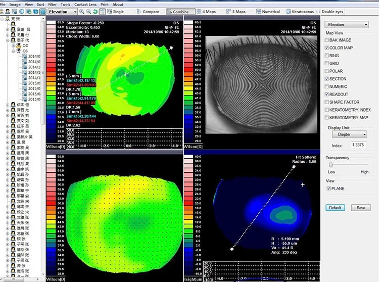 Topógrafo Corneal SW-6000